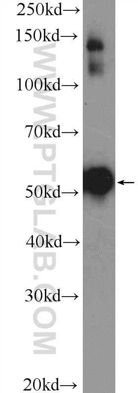 Western Blot (WB) analysis of HepG2 cells using Cytokeratin 7-specific Polyclonal antibody (17513-1-AP)