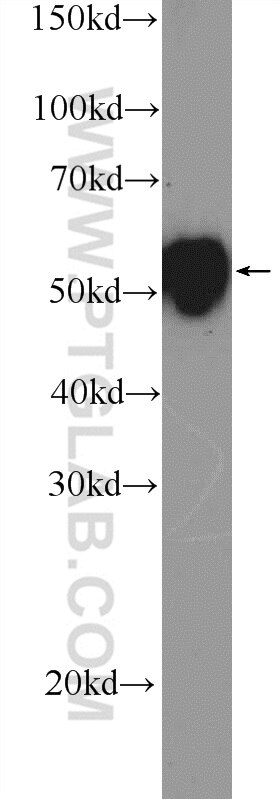 Cytokeratin 7-specific Polyclonal antibody