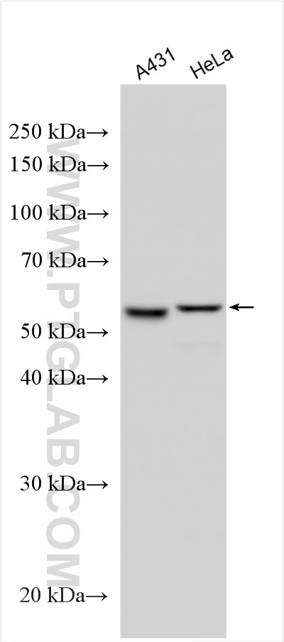 Western Blot (WB) analysis of various lysates using Cytokeratin 7-specific Polyclonal antibody (17513-1-AP)