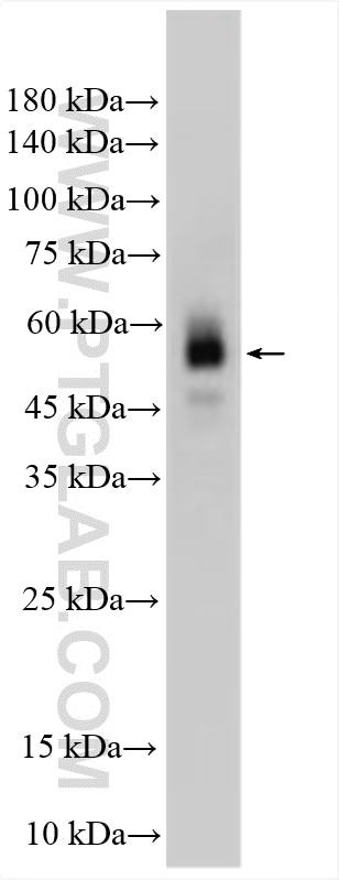 Western Blot (WB) analysis of T-47D cells using Cytokeratin 7-specific Polyclonal antibody (17513-1-AP)