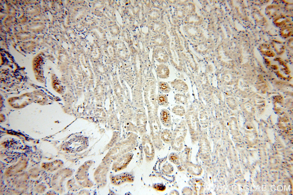 Cytokeratin 7-specific