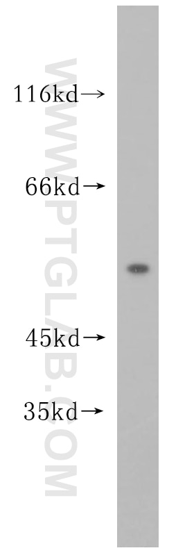 Western Blot (WB) analysis of HepG2 cells using Cytokeratin 7-specific Polyclonal antibody (16857-1-AP)