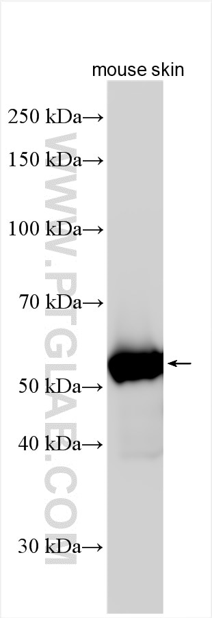 mouse skin tissue were subjected to SDS PAGE followed by western blot with 26149-1-AP (KRT71 antibody) at dilution of 1:1000 incubated at room temperature for 1.5 hours. Western Blot (WB) analysis of mouse skin tissue using KRT71 Polyclonal antibody (26149-1-AP)