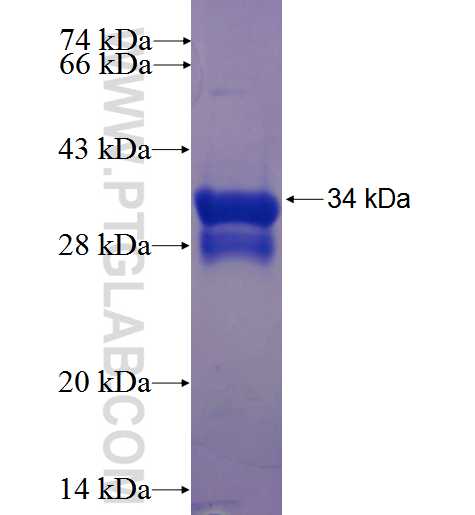 KRT71 fusion protein Ag23536 SDS-PAGE