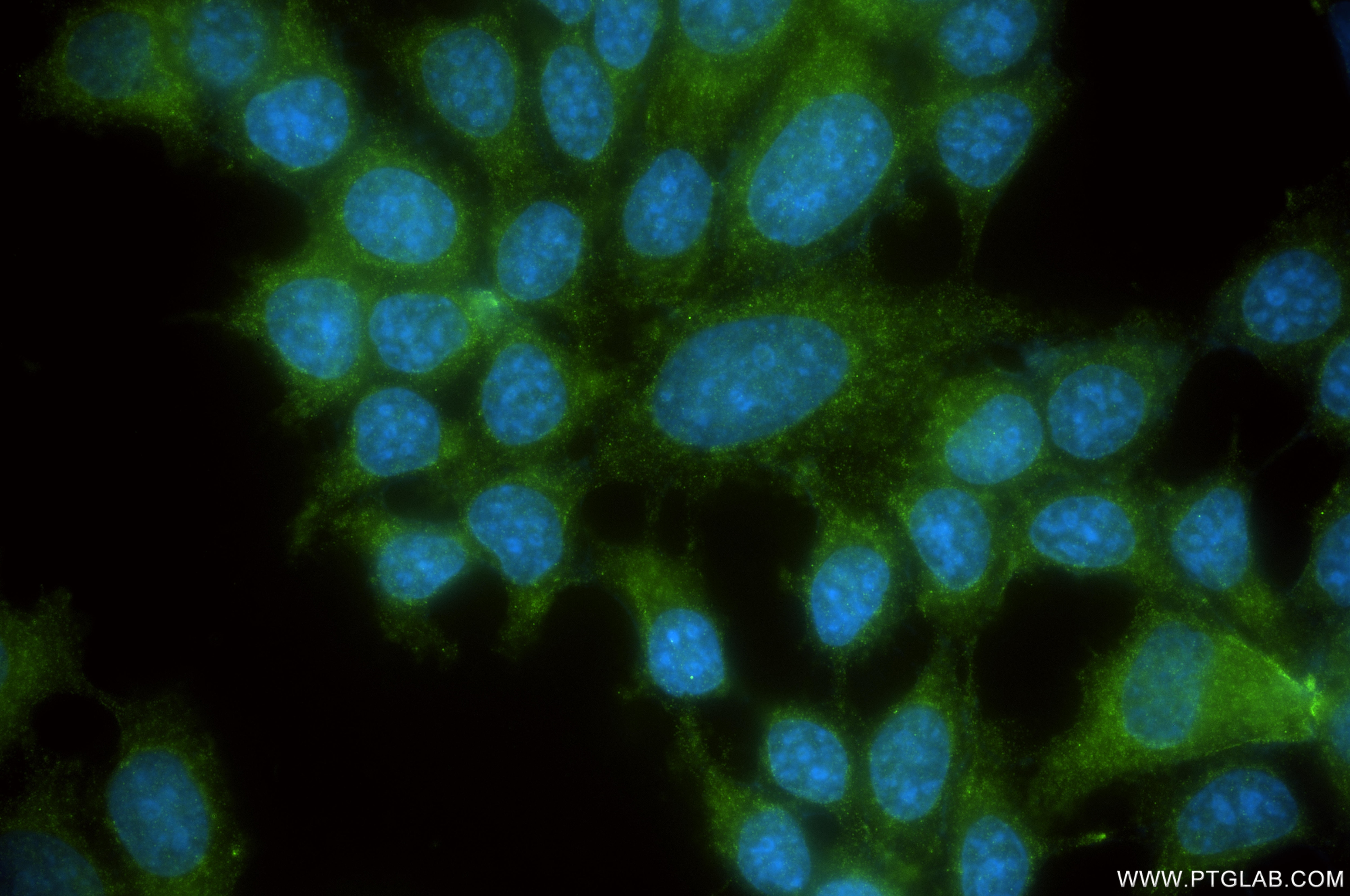 Immunofluorescence (IF) / fluorescent staining of MCF-7 cells using KRT72 Recombinant monoclonal antibody (86311-2-RR)