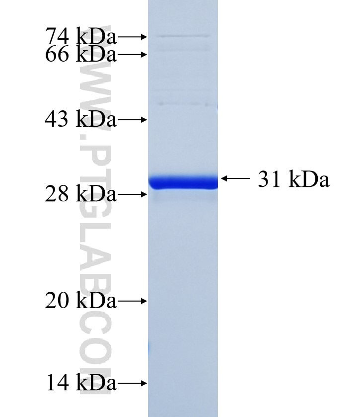 KRT72 fusion protein Ag35944 SDS-PAGE KRT72 fusion protein Ag35944 SDS-PAGE