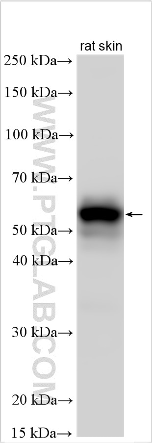 Western Blot (WB) analysis of various lysates using KRT73 Polyclonal antibody (27055-1-AP)