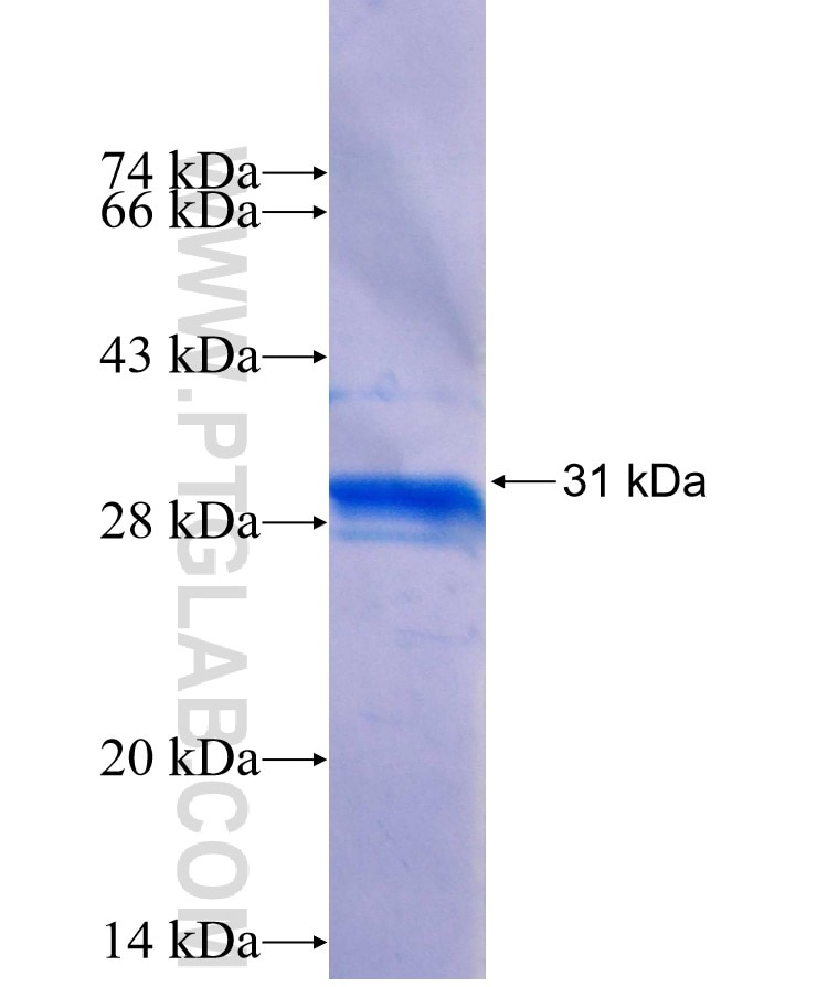 KRT73 fusion protein Ag25716 SDS-PAGE