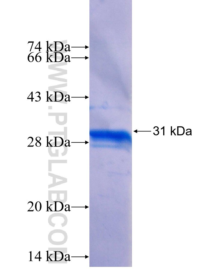 KRT73 fusion protein Ag25716 SDS-PAGE