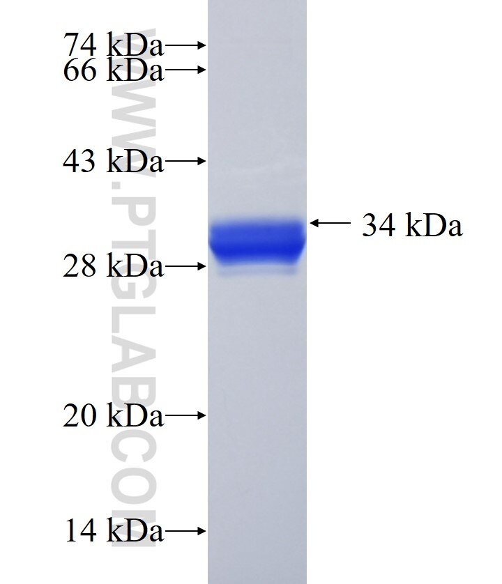 KRT77 fusion protein Ag21942 SDS-PAGE