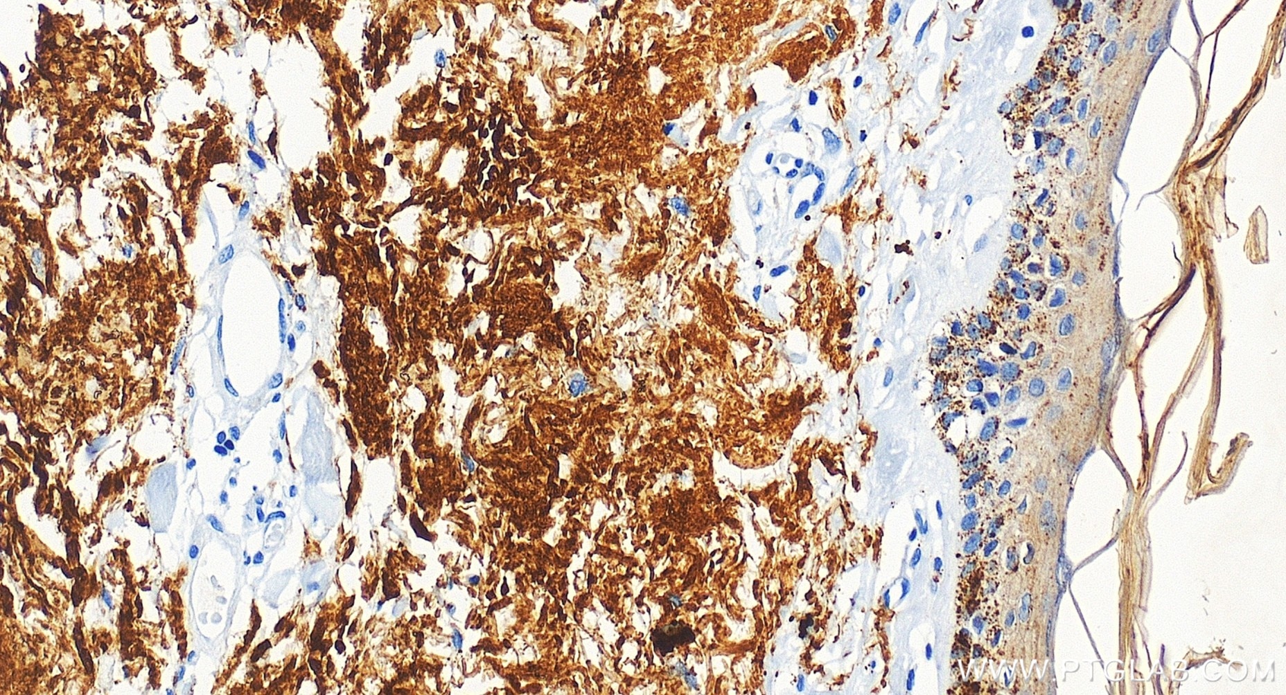 Immunohistochemistry (IHC) staining of human skin tissue using Cytokeratin 78 Recombinant monoclonal antibody (86328-1-RR)