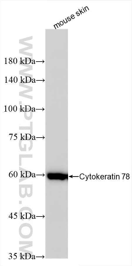 Western Blot (WB) analysis of mouse skin tissue using KRT78 Recombinant antibody (86328-1-RR)
