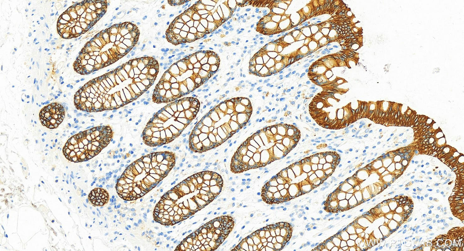 Immunohistochemistry (IHC) staining of human colon tissue using Cytokeratin 8 Polyclonal antibody (10384-1-AP)