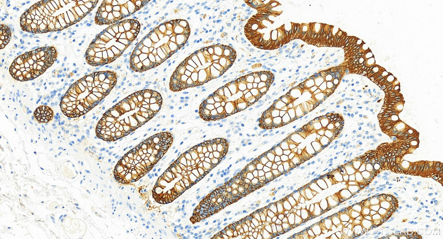 Immunohistochemistry (IHC) staining of human colon tissue using Cytokeratin 8 Polyclonal antibody (10384-1-AP)