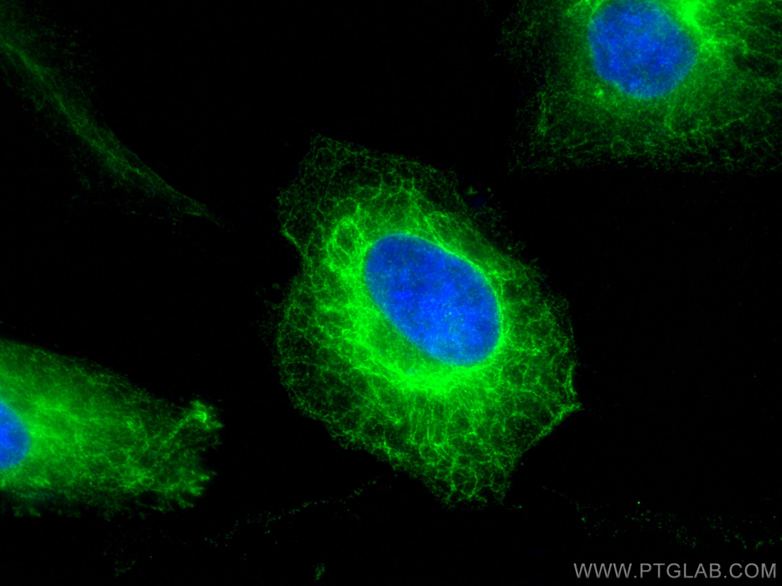 Immunofluorescence (IF) / fluorescent staining of HeLa cells using Cytokeratin 8 Polyclonal antibody (10384-1-AP)