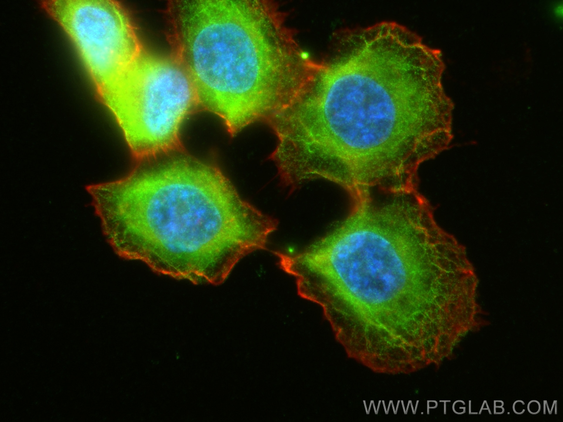 Immunofluorescence (IF) / fluorescent staining of A431 cells using Cytokeratin 8 Polyclonal antibody (10384-1-AP)