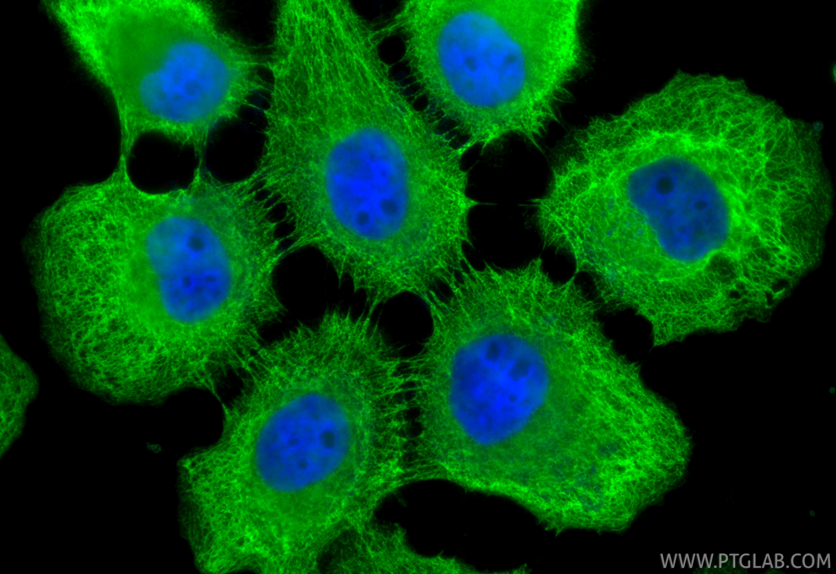 Immunofluorescence (IF) / fluorescent staining of A431 cells using Cytokeratin 8 Polyclonal antibody (10384-1-AP)