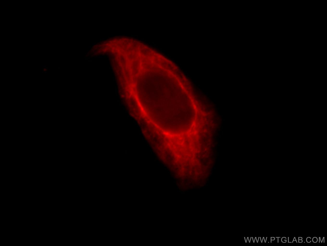Immunofluorescence (IF) / fluorescent staining of HepG2 cells using Cytokeratin 8 Polyclonal antibody (10384-1-AP)