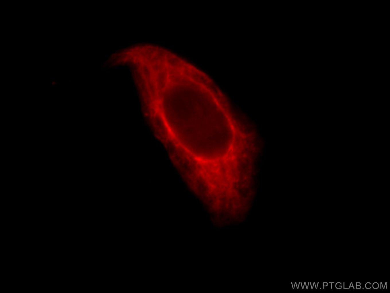 IF Staining of HepG2 using 10384-1-AP