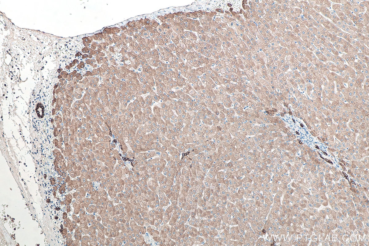 Immunohistochemistry (IHC) staining of human liver tissue using Cytokeratin 8 Polyclonal antibody (10384-1-AP)