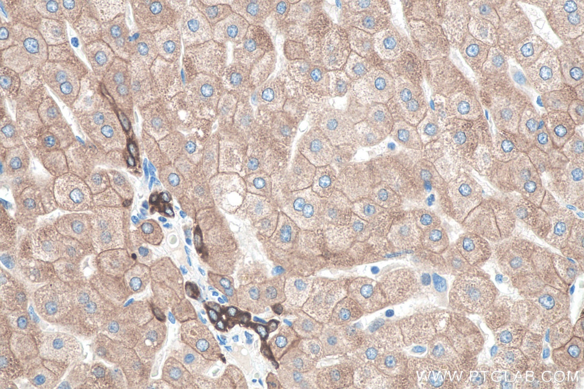 Immunohistochemistry (IHC) staining of human liver tissue using Cytokeratin 8 Polyclonal antibody (10384-1-AP)