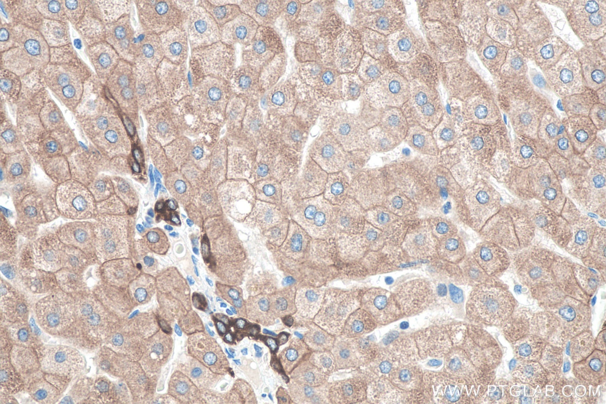 IHC staining of human liver using 10384-1-AP