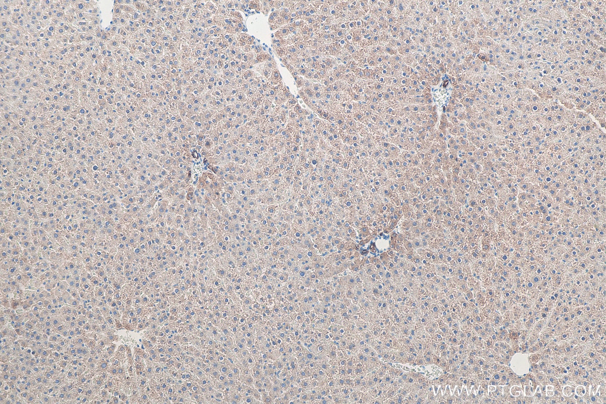 IHC staining of rat liver using 10384-1-AP Immunohistochemistry (IHC) staining of rat liver tissue using Cytokeratin 8 Polyclonal antibody (10384-1-AP)