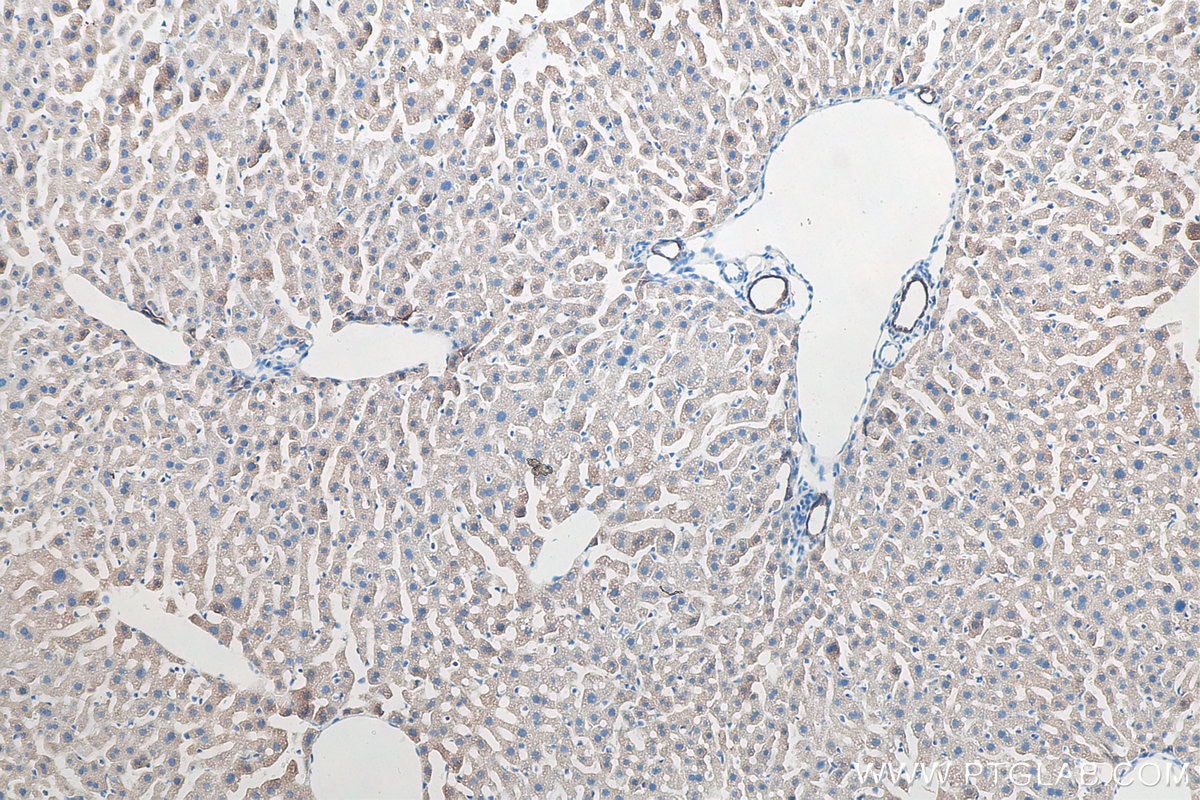 IHC staining of mouse liver using 10384-1-AP Immunohistochemistry (IHC) staining of mouse liver tissue using Cytokeratin 8 Polyclonal antibody (10384-1-AP)