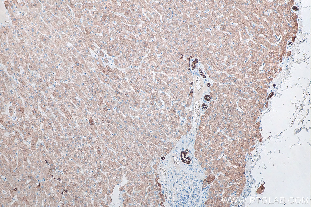 IHC staining of human liver using 10384-1-AP Immunohistochemistry (IHC) staining of human liver tissue using Cytokeratin 8 Polyclonal antibody (10384-1-AP)