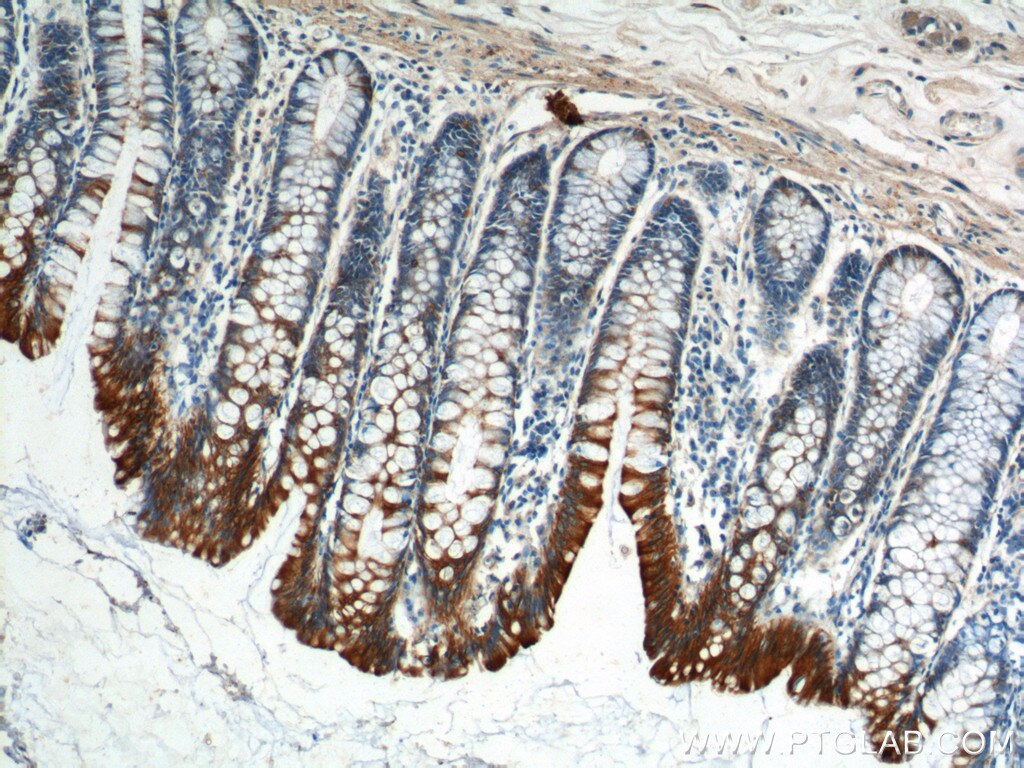 Immunohistochemistry (IHC) staining of human colon tissue using Cytokeratin 8 Polyclonal antibody (10384-1-AP)