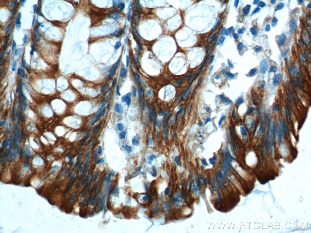 Immunohistochemistry (IHC) staining of human colon tissue using Cytokeratin 8 Polyclonal antibody (10384-1-AP)