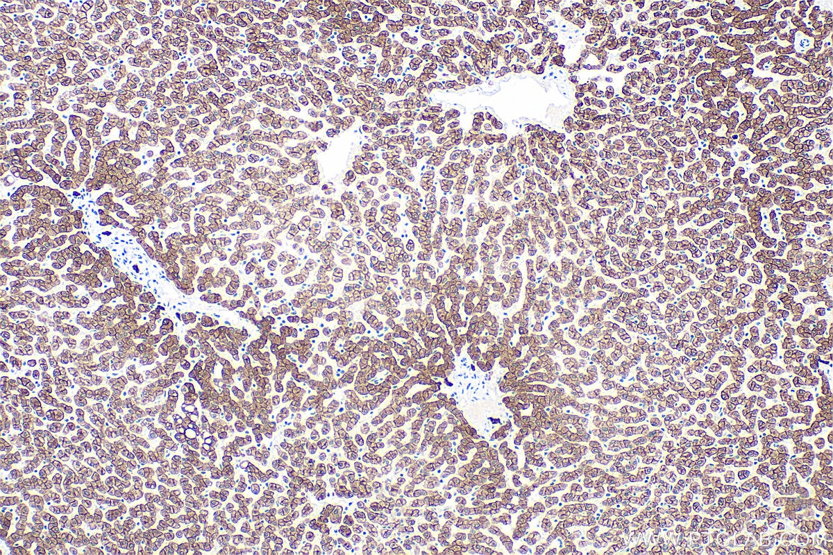Immunohistochemistry (IHC) staining of human liver tissue using Cytokeratin 8 Polyclonal antibody (10384-1-AP)