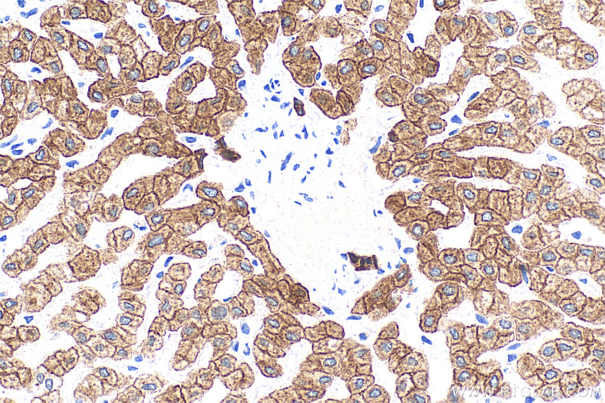 Immunohistochemistry (IHC) staining of human liver tissue using Cytokeratin 8 Polyclonal antibody (10384-1-AP)