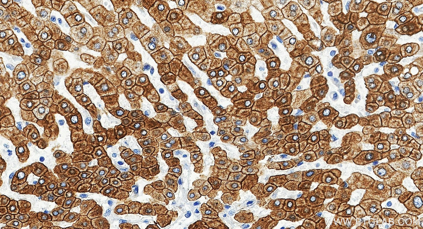 Immunohistochemistry (IHC) staining of human liver tissue using Cytokeratin 8 Polyclonal antibody (10384-1-AP)