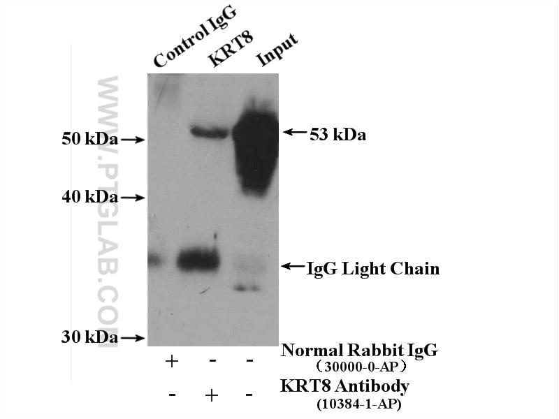 Immunoprecipitation (IP) experiment of HeLa cells using Cytokeratin 8 Polyclonal antibody (10384-1-AP)