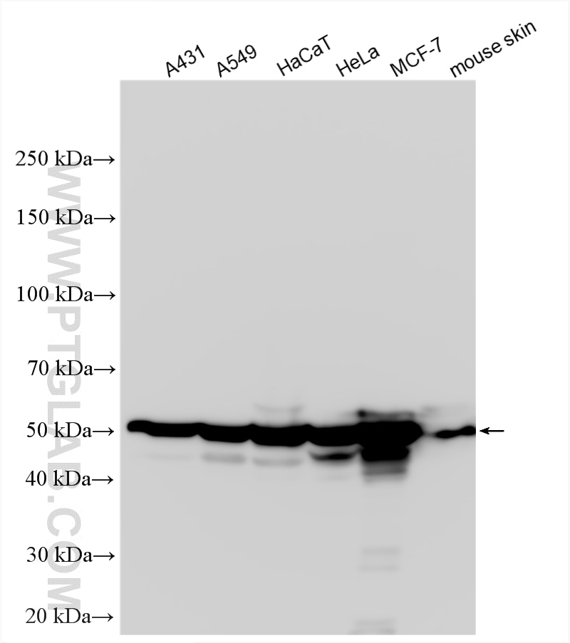 Western Blot (WB) analysis of various lysates using Cytokeratin 8 Polyclonal antibody (10384-1-AP)
