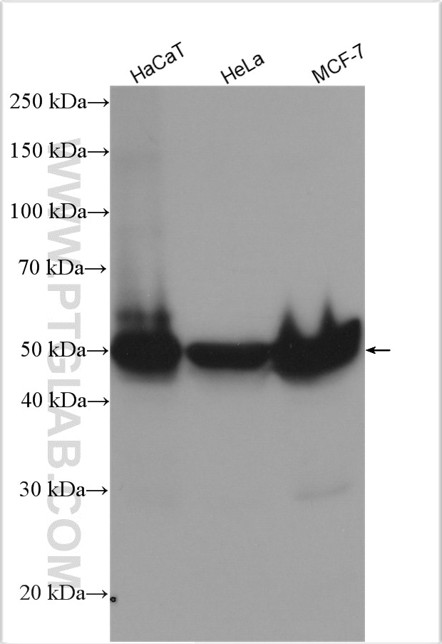 Western Blot (WB) analysis of various lysates using Cytokeratin 8 Polyclonal antibody (10384-1-AP)