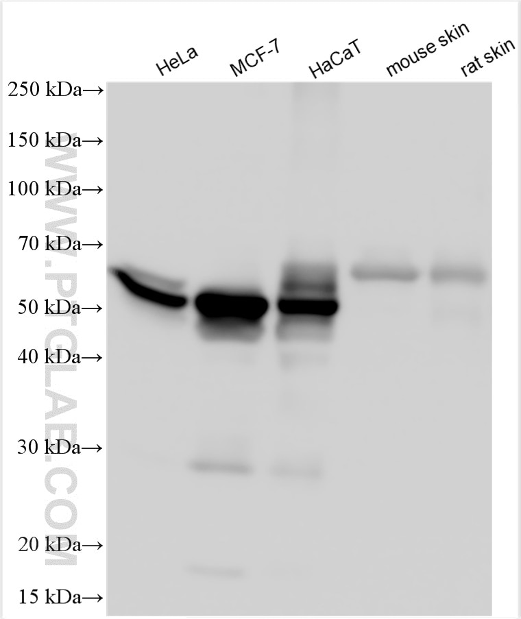 Western Blot (WB) analysis of various lysates using Cytokeratin 8 Polyclonal antibody (10384-1-AP)