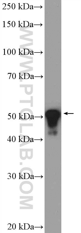 Western Blot (WB) analysis of A431 cells using Cytokeratin 8 Polyclonal antibody (10384-1-AP)