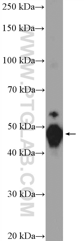 Western Blot (WB) analysis of A549 cells using Cytokeratin 8 Polyclonal antibody (10384-1-AP)