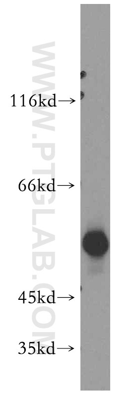 Western Blot (WB) analysis of COLO 320 cells using Cytokeratin 8 Polyclonal antibody (10384-1-AP)