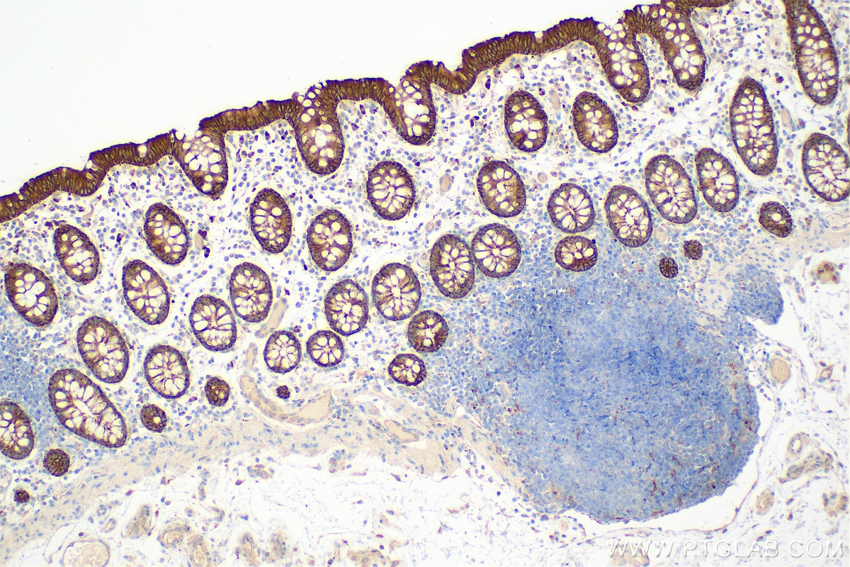 Immunohistochemistry (IHC) staining of human colon tissue using Cytokeratin 8 Polyclonal antibody (17514-1-AP)