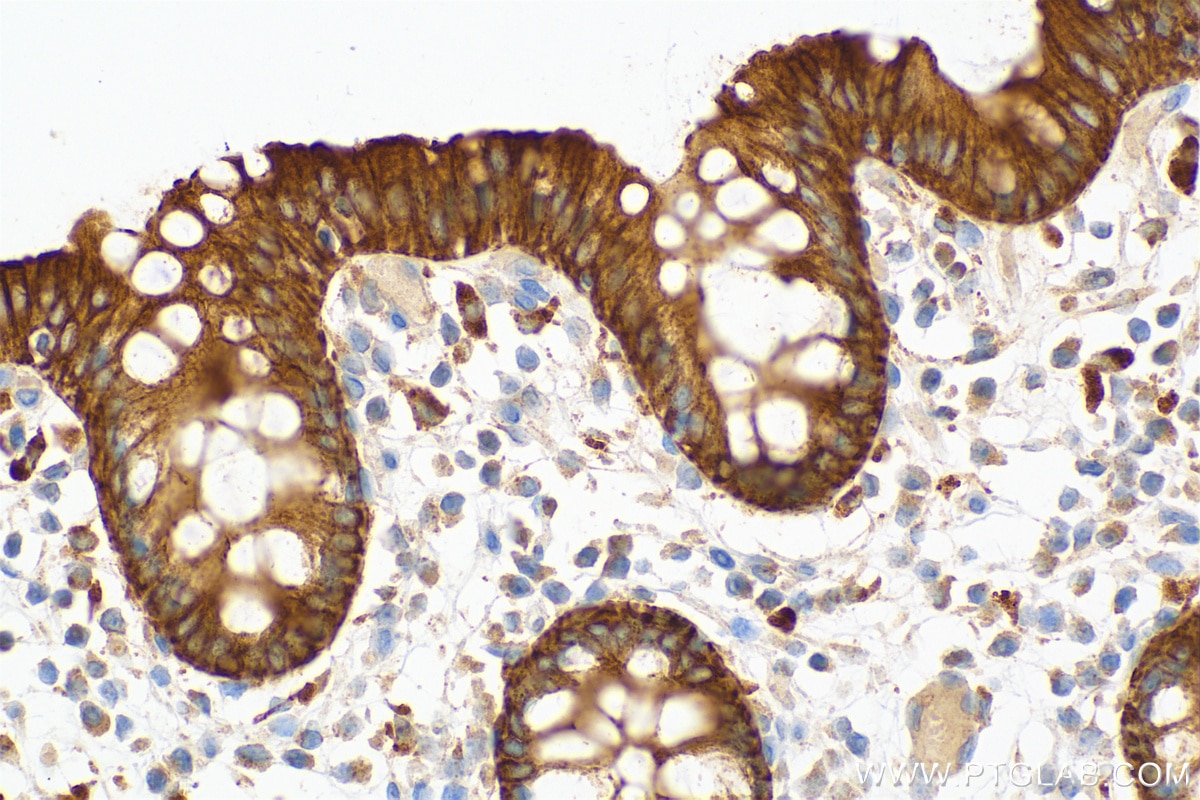 Immunohistochemistry (IHC) staining of human colon tissue using Cytokeratin 8 Polyclonal antibody (17514-1-AP)