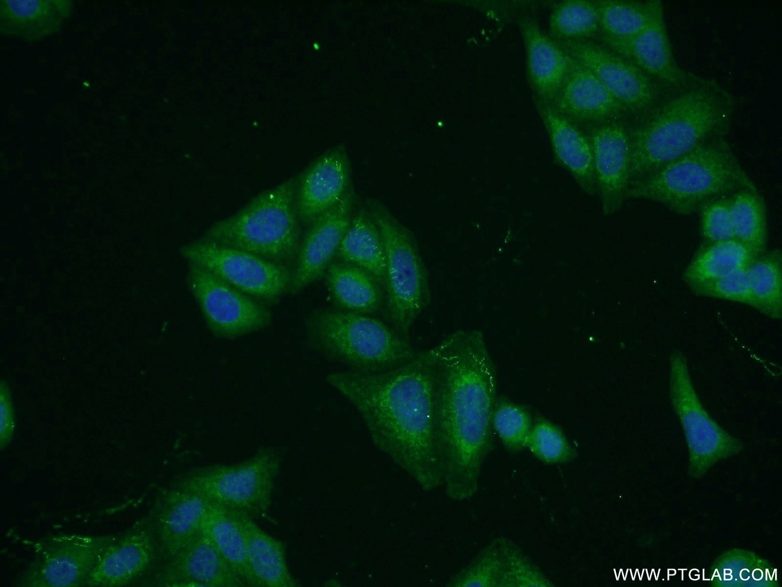 Cytokeratin 8 Polyclonal antibody