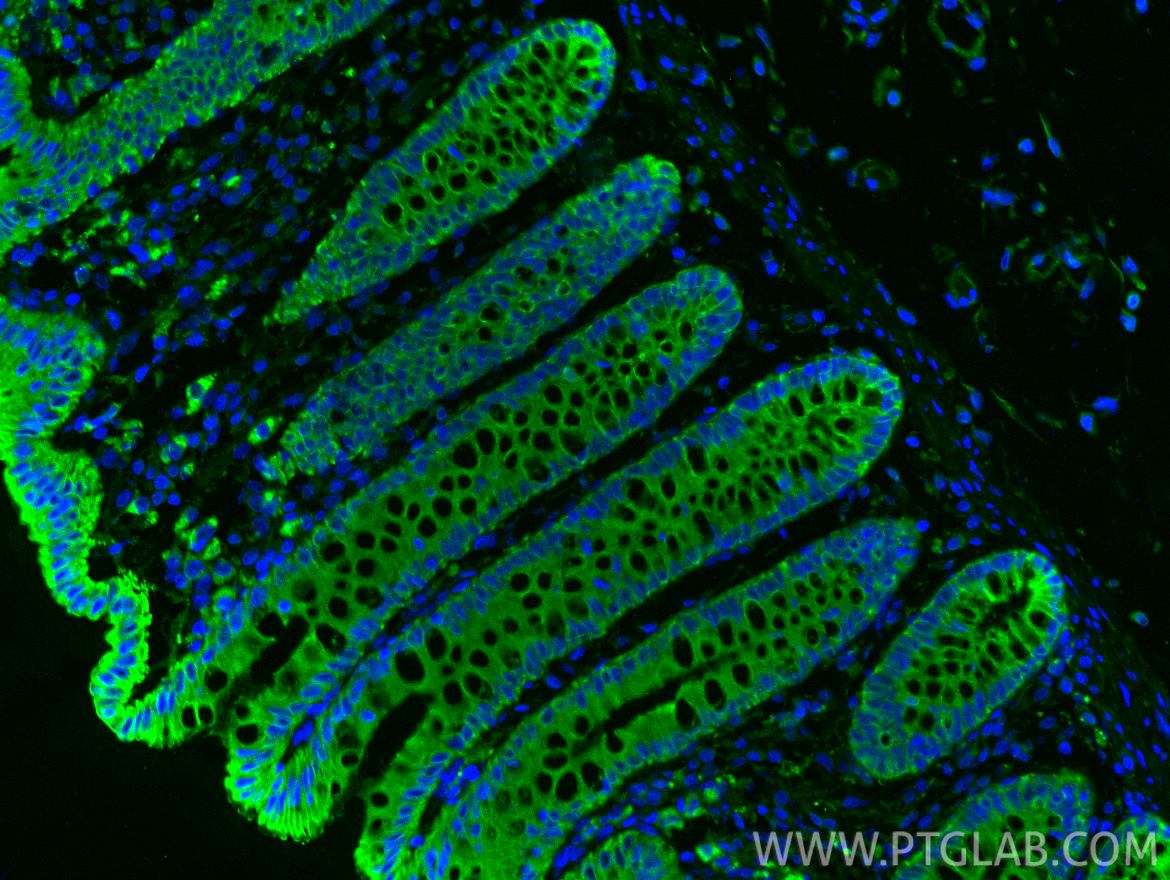 Immunofluorescent analysis of (4% PFA) fixed paraffin-embedded human colon tissue using Cytokeratin 8 antibody (17514-1-AP) at dilution of 1:200 and CoraLite®488-Conjugated Goat Anti-Rabbit IgG(H+L) (SA00013-2). Heat mediated antigen retrieval with Tris-EDTA buffer (pH 9.0). Immunofluorescence (IF) / fluorescent staining of human colon tissue using Cytokeratin 8 Polyclonal antibody (17514-1-AP)