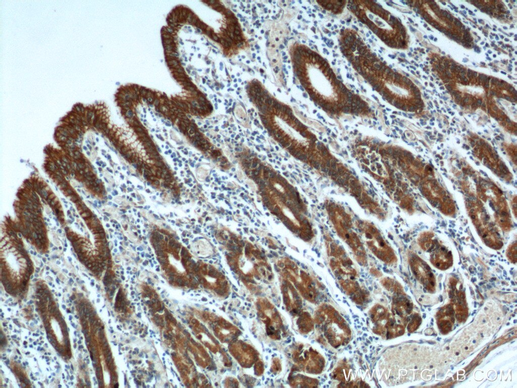 Immunohistochemistry (IHC) staining of human stomach tissue using Cytokeratin 8 Polyclonal antibody (17514-1-AP)