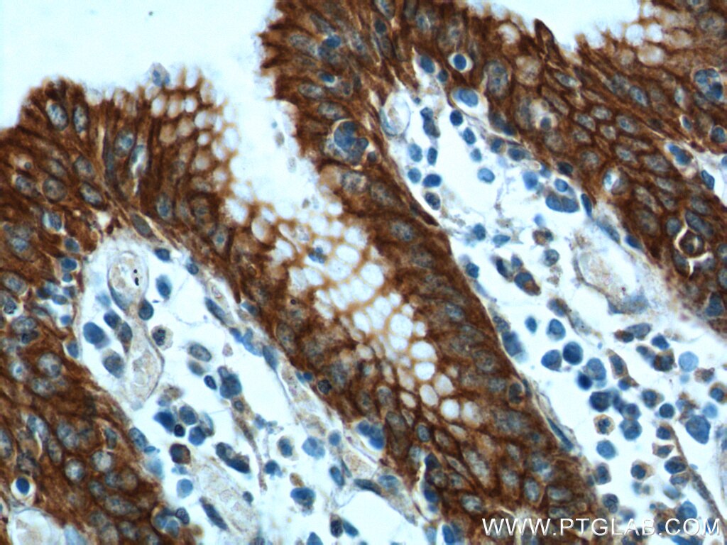 Immunohistochemistry (IHC) staining of human stomach tissue using Cytokeratin 8 Polyclonal antibody (17514-1-AP)