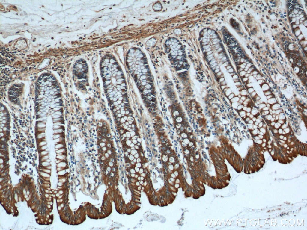 Immunohistochemistry (IHC) staining of human colon tissue using Cytokeratin 8 Polyclonal antibody (17514-1-AP)