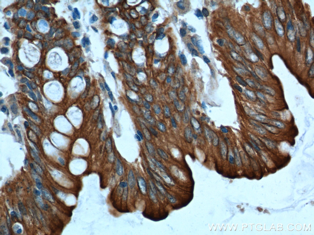 Immunohistochemistry (IHC) staining of human colon tissue using Cytokeratin 8 Polyclonal antibody (17514-1-AP)