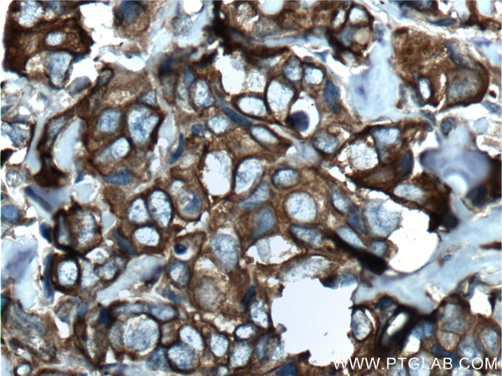 Cytokeratin 8 Polyclonal antibody